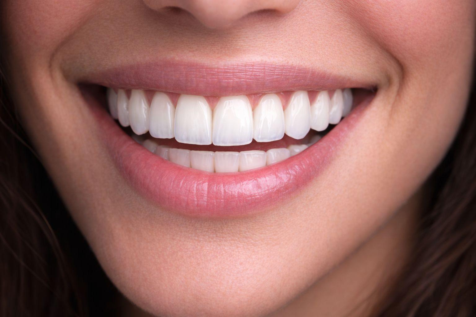 Crowns & Restorations