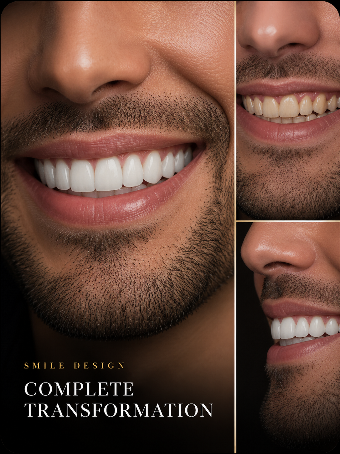 Smile Design