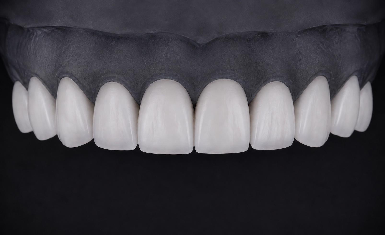 Low translucency · Minimal anatomy masculine square ceramic design