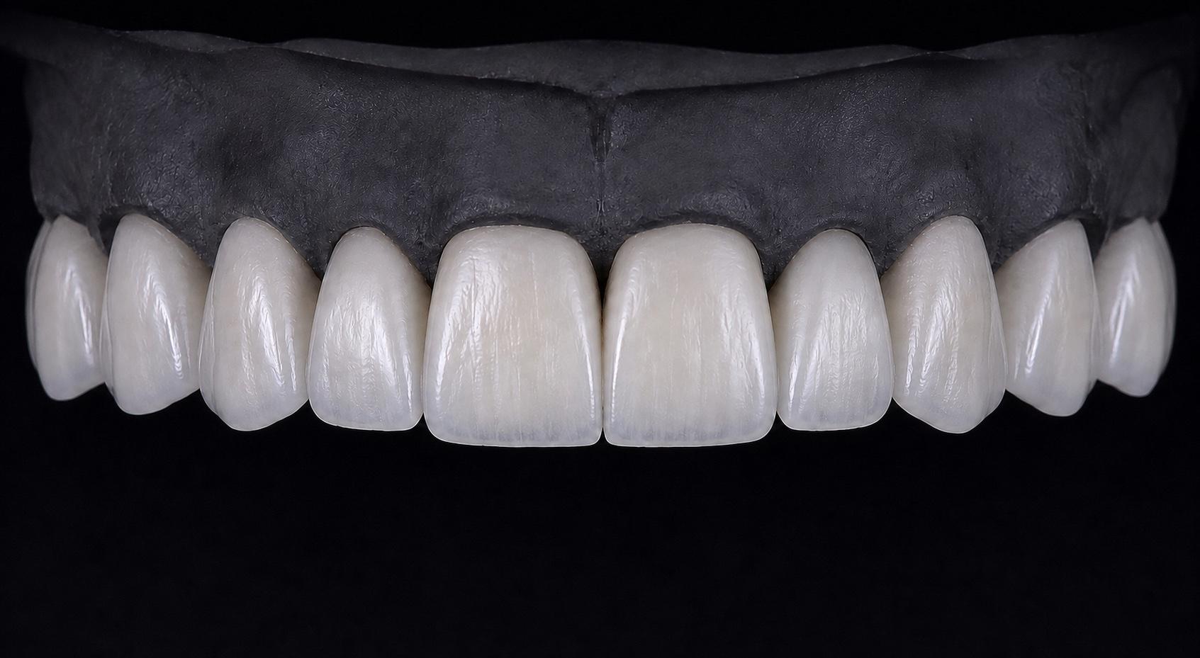 With translucency · Anatomical accents masculine square ceramic design