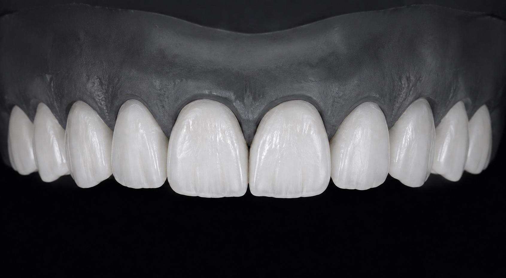 Low translucency · Anatomical accents feminine ceramic design