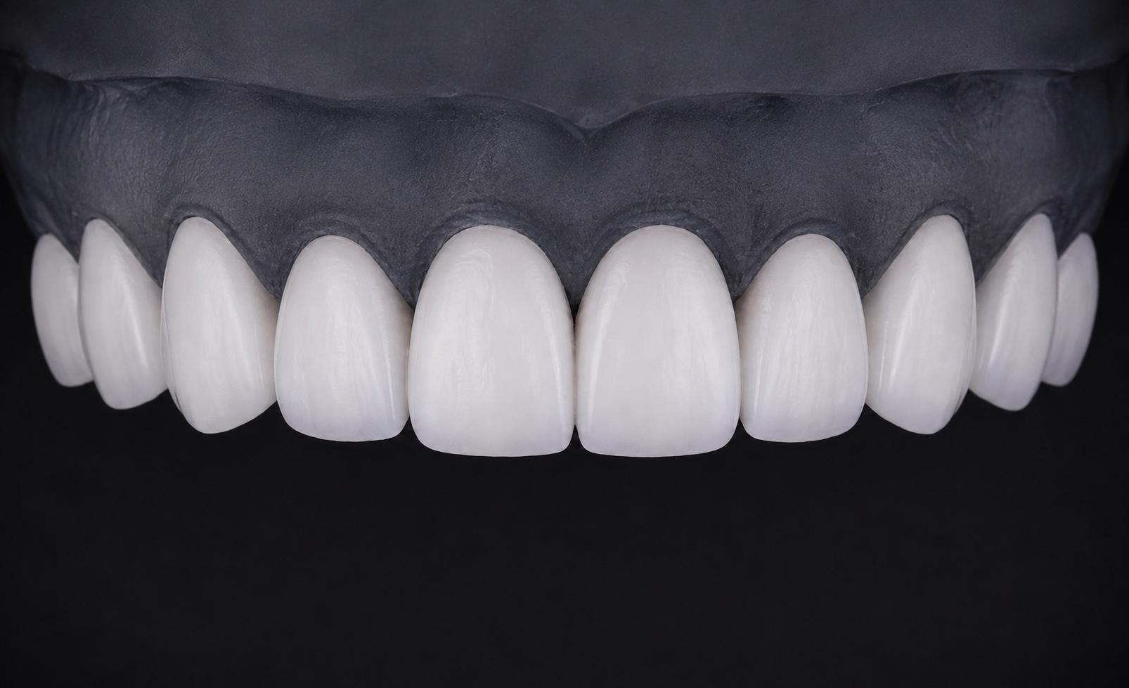 Low translucency · Minimal anatomy feminine ceramic design