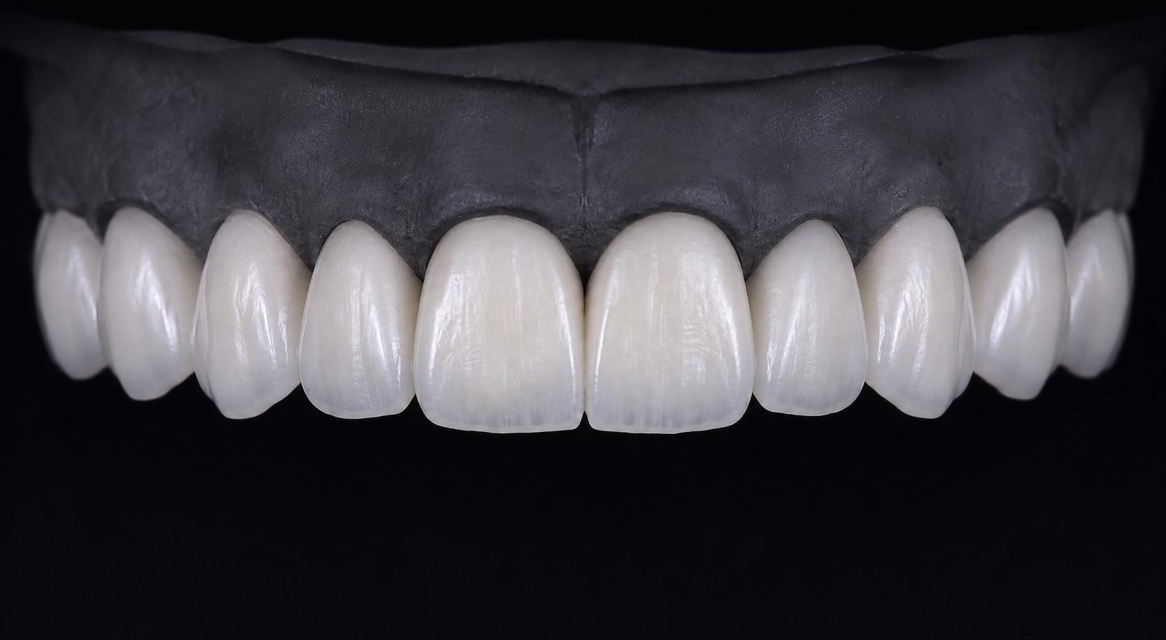 With translucency · Anatomical accents feminine ceramic design